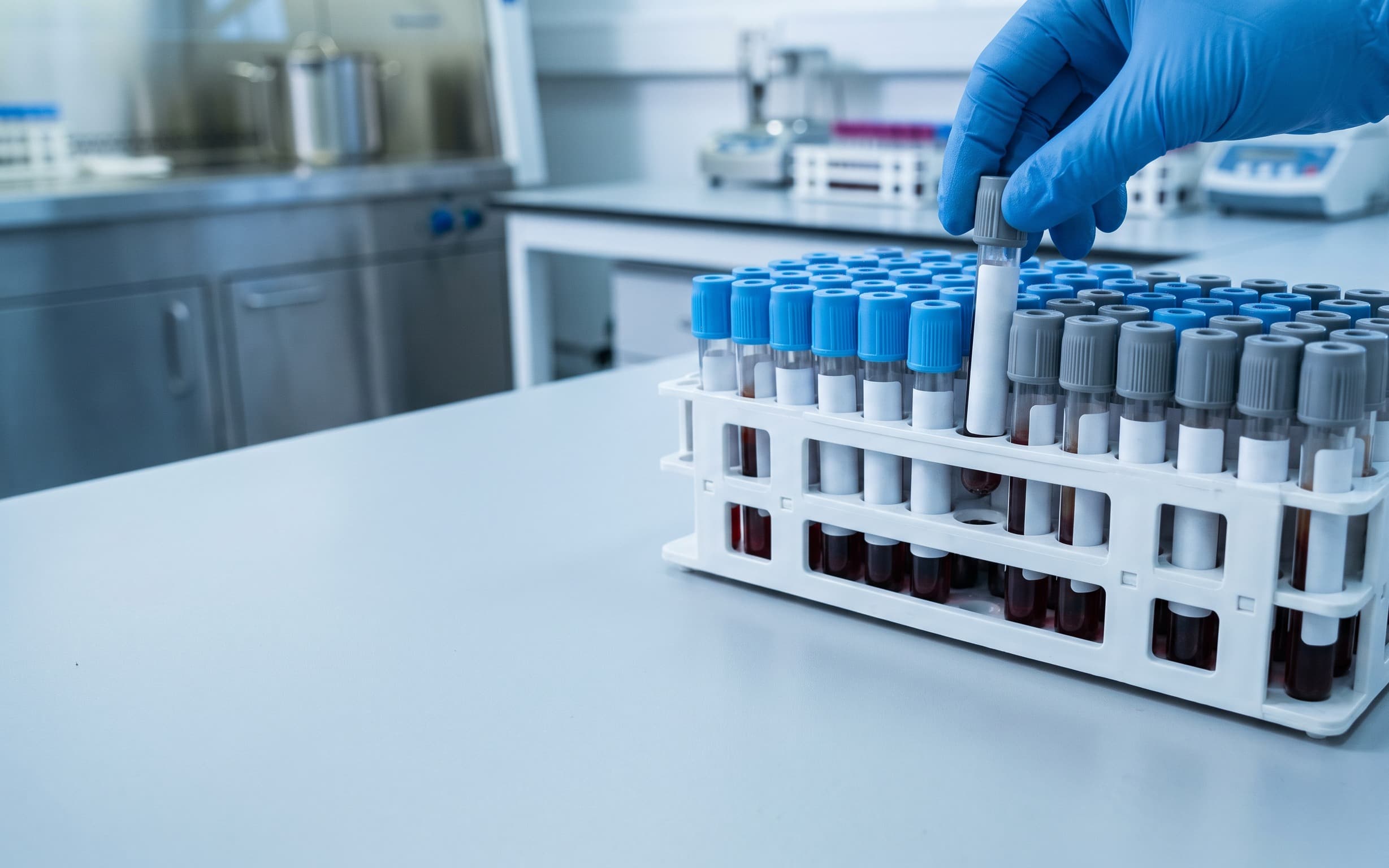 Labeled specimen tubes prepared for a collection study