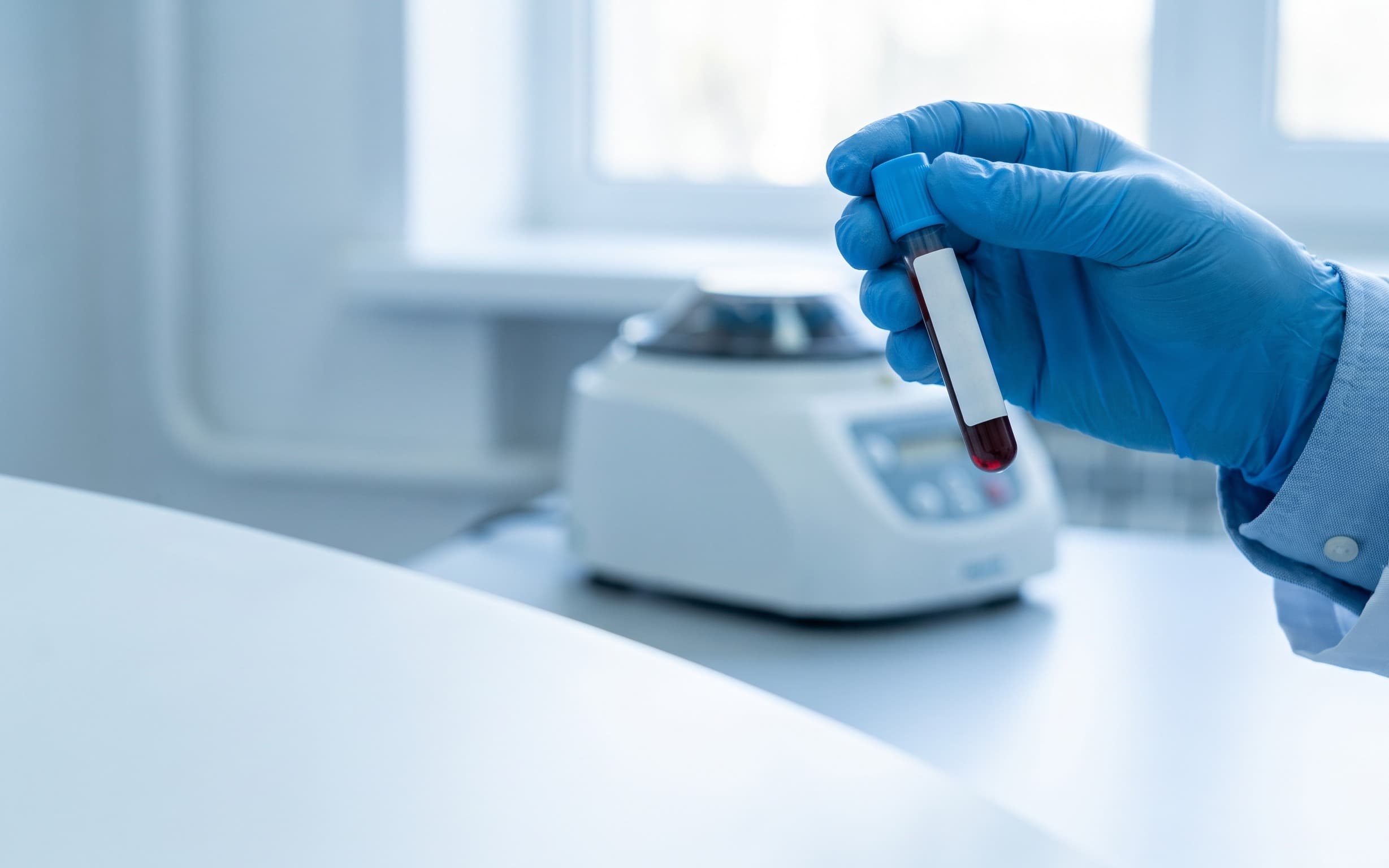 Blood lipid reference for a hypertriglyceridemia study