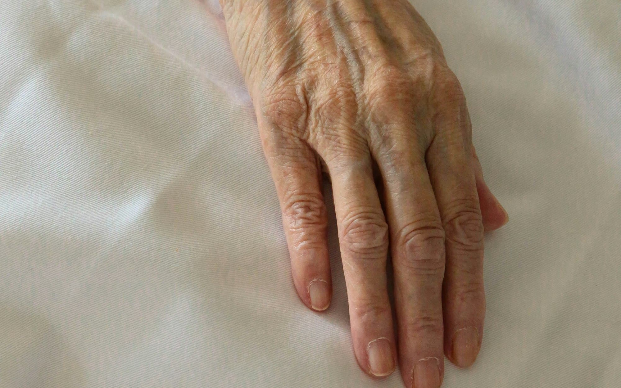 Hand joint assessment for a rheumatoid arthritis protocol